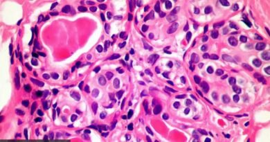 Image de cellules cancéreuses